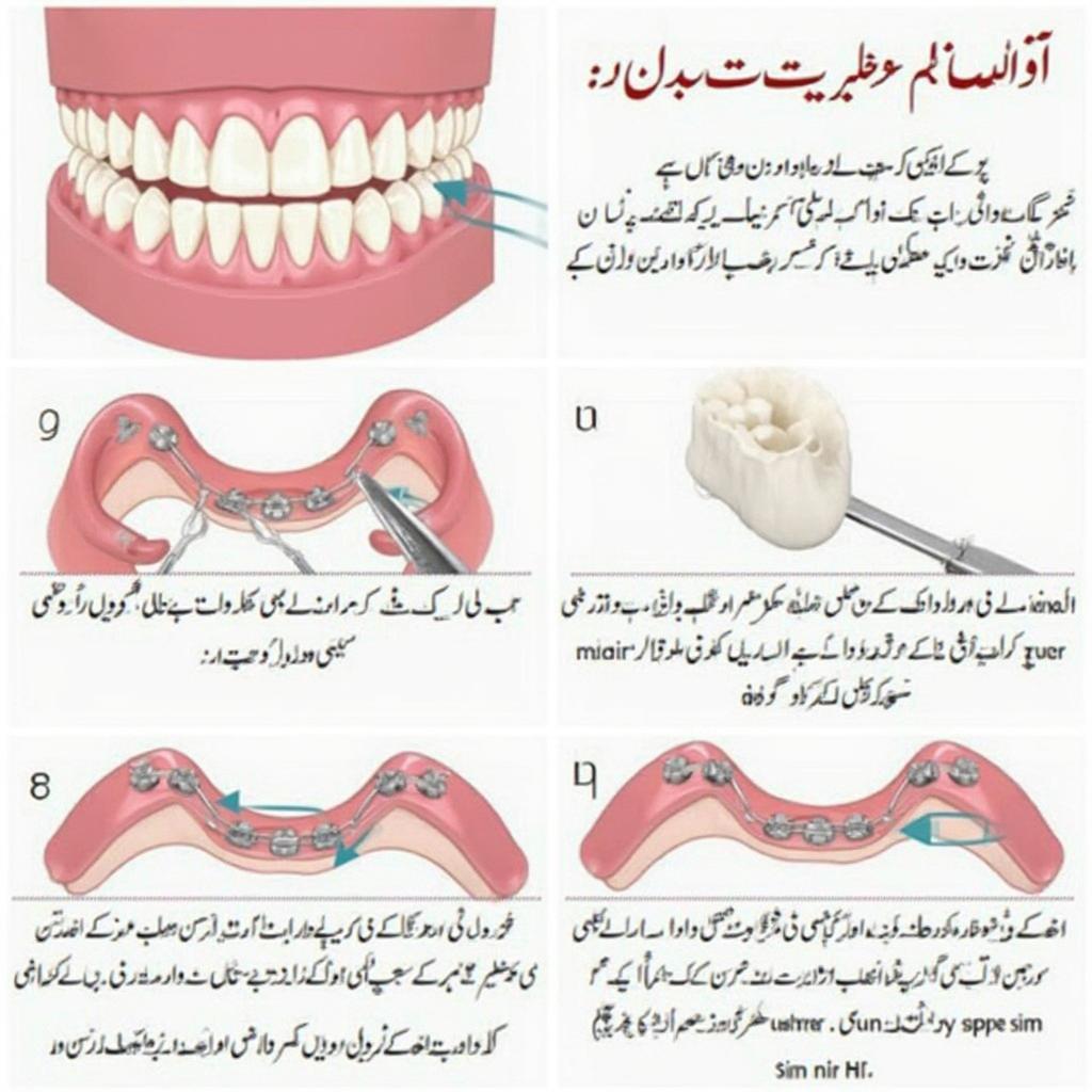 Caring for Braces in Urdu