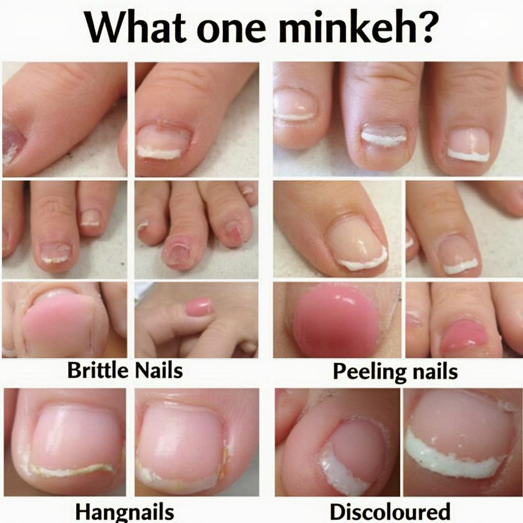 Common Nail Problems Encountered in the UK