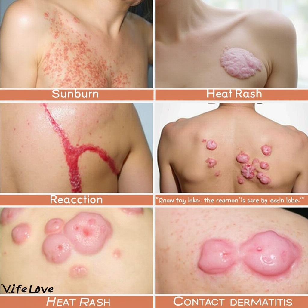 Examples of common summer skin issues like sunburn and heat rash.