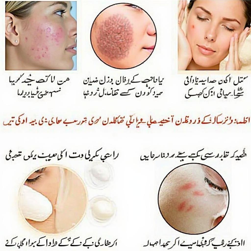 Images showing Urdu skin care solutions